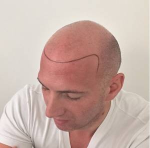 Hair Tattoo Melbourne