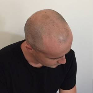 Hair Tattoo