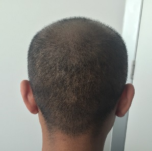 Hair Tattoo Melbourne