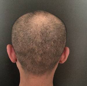 Hair Tattoo Melbourne