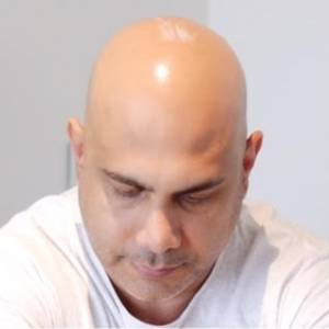 Scalp Micropigmentation Before After