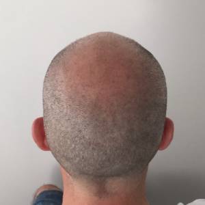 Hair Tattoo Melbourne
