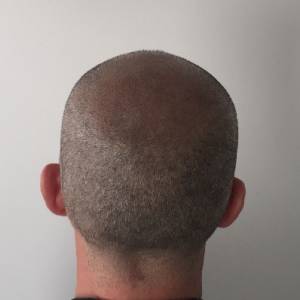 Hair Tattoo Melbourne