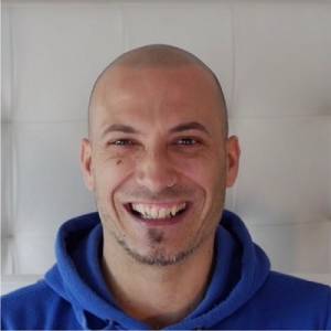 Scalp Micropigmntation