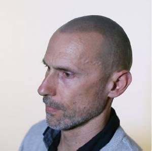 scalp micropigmentation