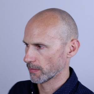 scalp micropigmentation