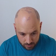 Hair Tattoo