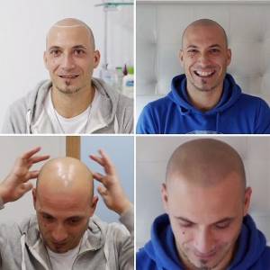 hair tattoo