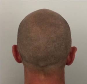 hair tattoo