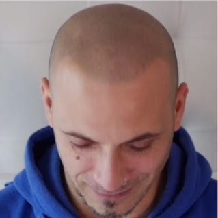 Hair Tattoo Sydney