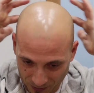 Hair Tattoo Sydney